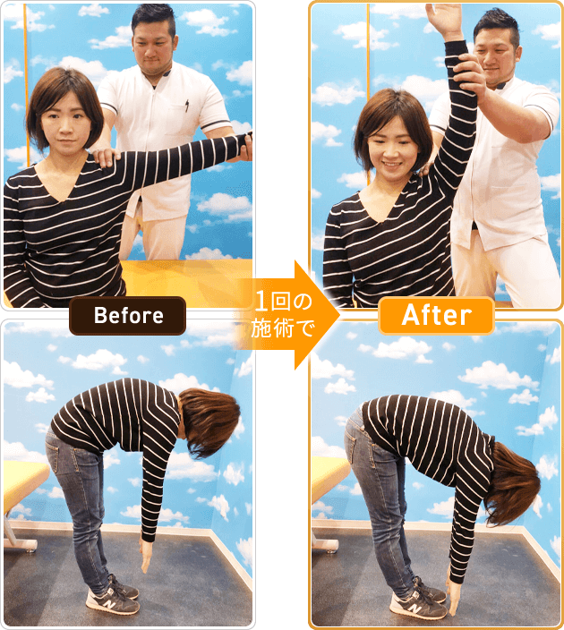 Before After